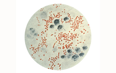 Visual Representations of the Third Plague Pandemic<
