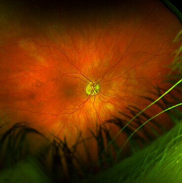 Retina of an eye.